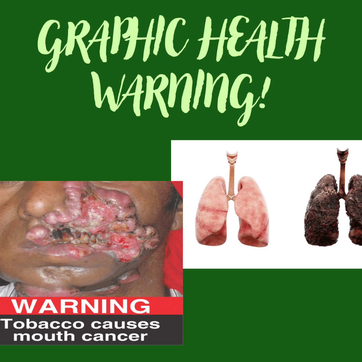 Graphic Health Warnings – A Bold Step in Tobacco Control in&nbsp;Kenya